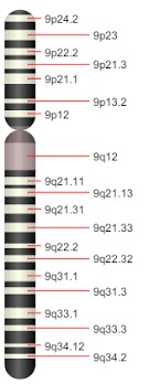 Trisomia9p_1.jpg