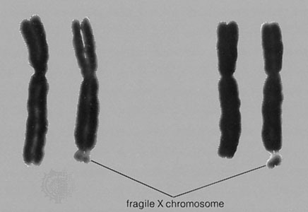 Xfragile_2.jpg