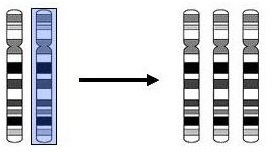 trisomia18_2.jpg