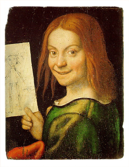 Sindrome di Angelman_1.jpg